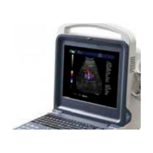 Ultrasound machine, portable